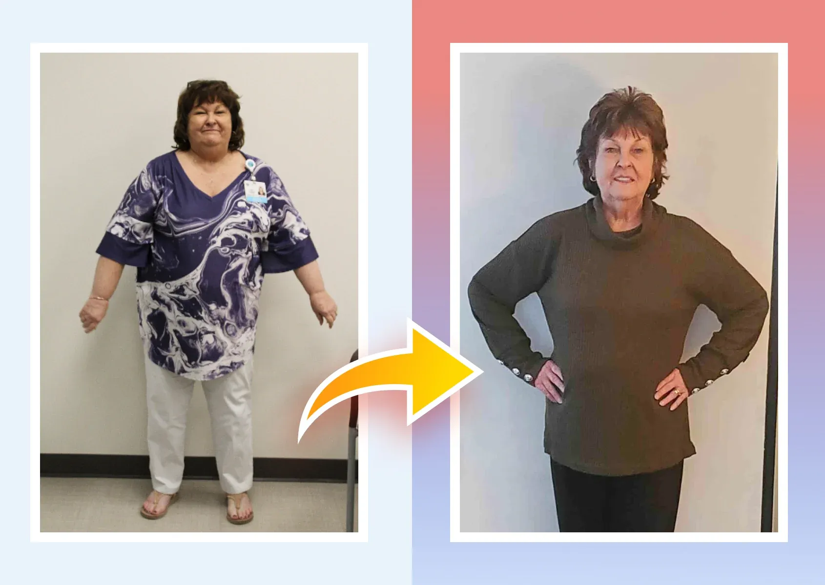Before and after photos of a real MDWatch patient